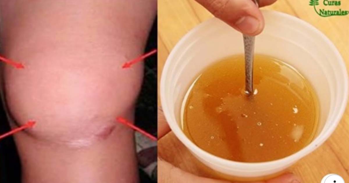 Gelatina sin sabor para columna, rodillas y articulaciones Tuve que verlo